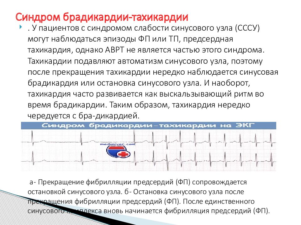 Синдром слабости синусового узла карта вызова смп