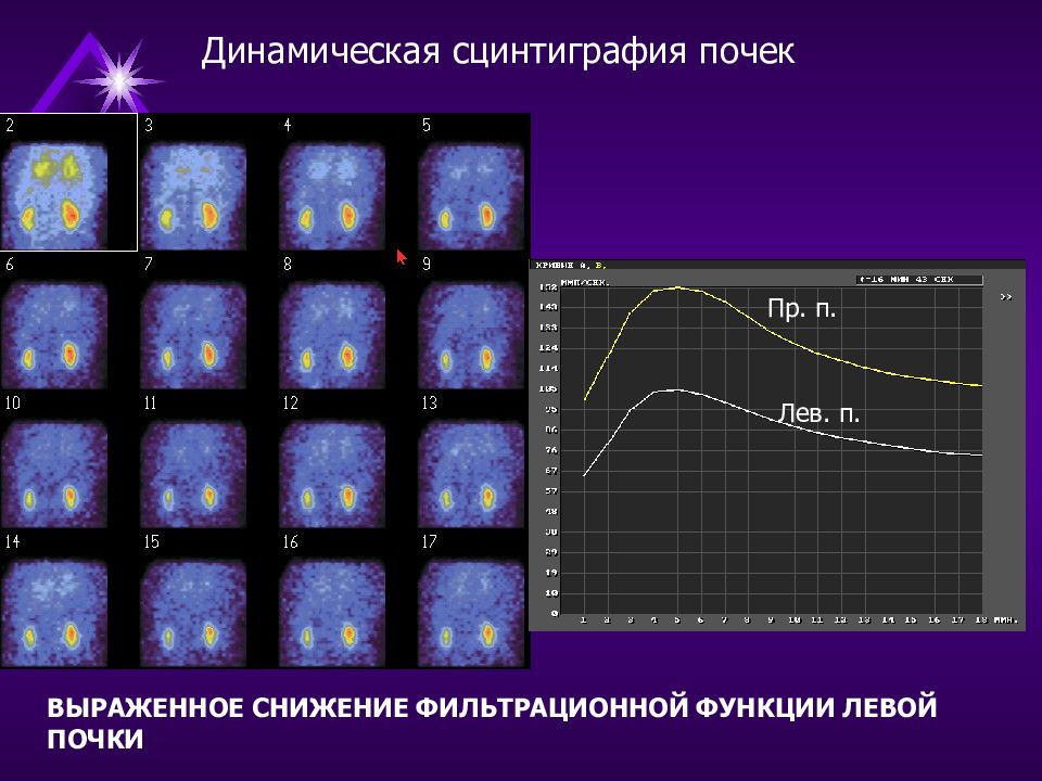 Радионуклидная диагностика фото