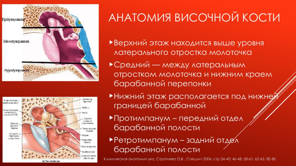 Холеастома. Холостом височной кости. Лучевая анатомия височной кости. Холестеатома височной кости. Холеастома височной кости.