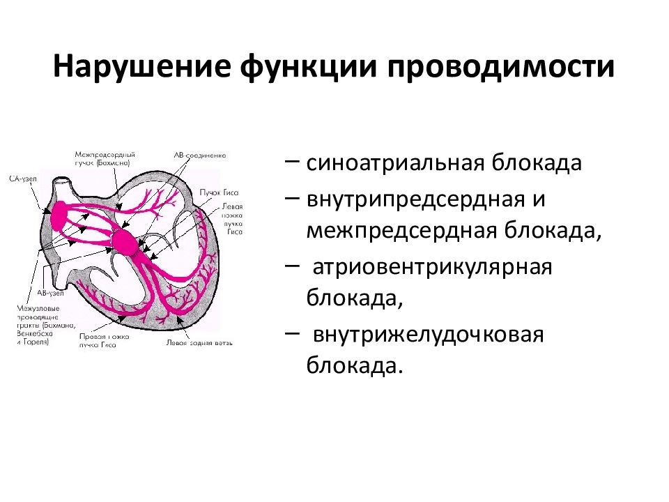 Нарушение внутрижелудочковой