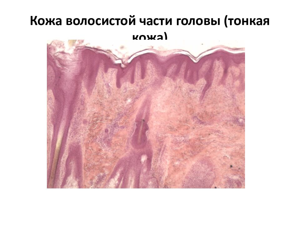 Кожа волосистой части головы (тонкая кожа)