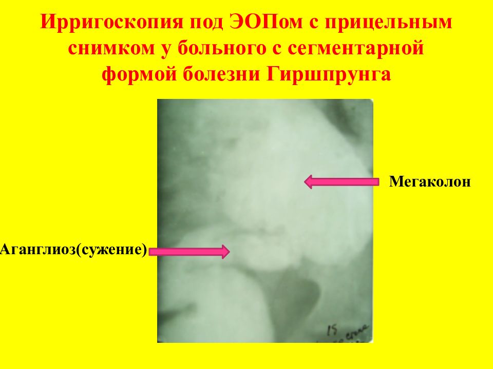 Ирригоскопия отзывы