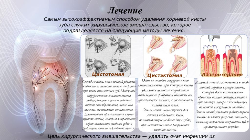 Радикулярная киста презентация