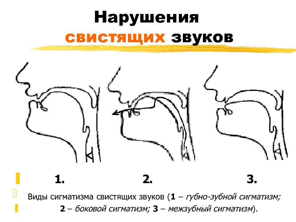 Постановка звука т презентация для дошкольников