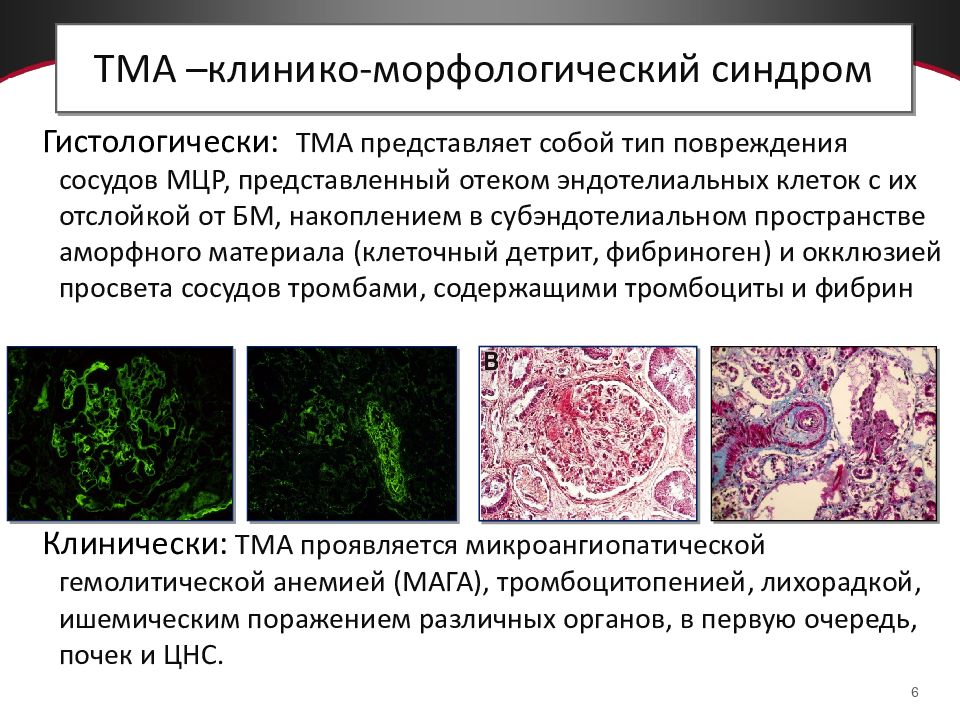 Признаки микроангиопатии головного мозга. Тромботические микроангиопатии (ТМА). ТМА патогенез. Клинические проявления микроангиопатии. ТМА В акушерстве.