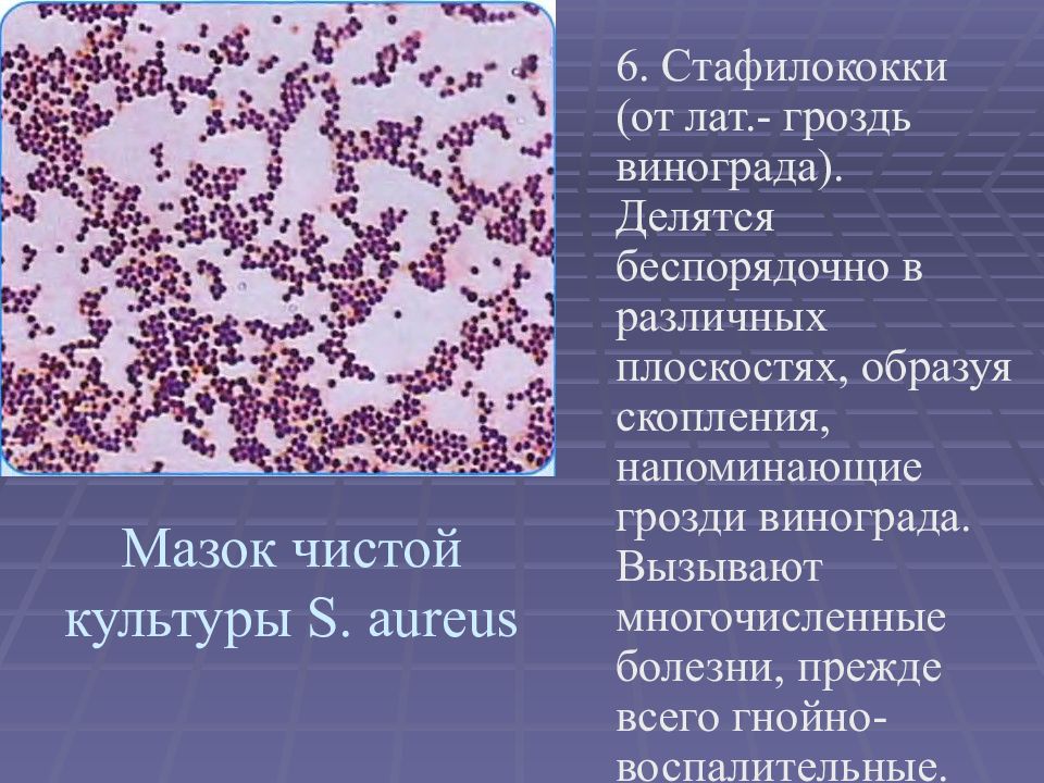 Staphylococcus aureus 3. Тинкториальные свойства золотистого стафилококка. Стафилококки генцианвиолет. Стафилококкус ауреус морфология. Чистая культура стафилококка ауреус.