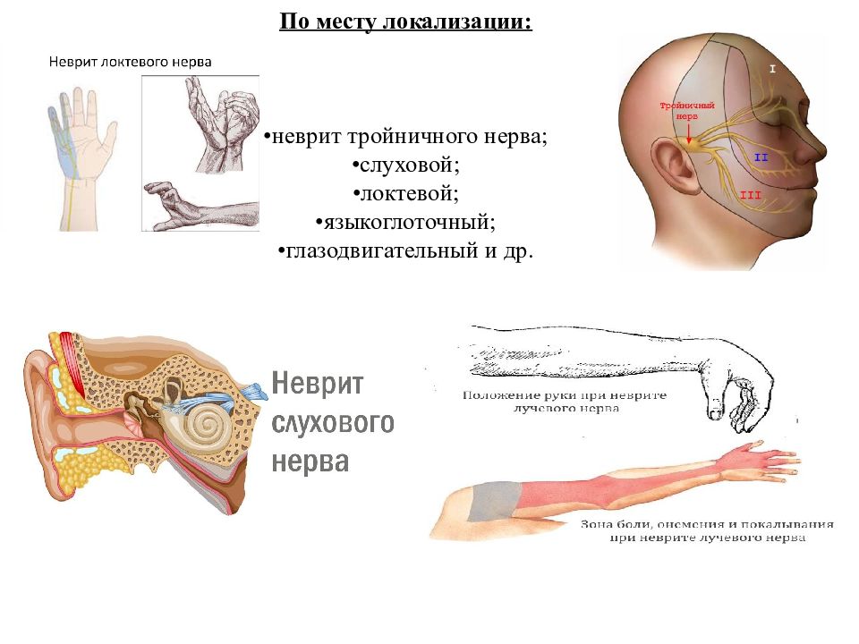 Воспаление тройничного нерва карта вызова скорой медицинской помощи