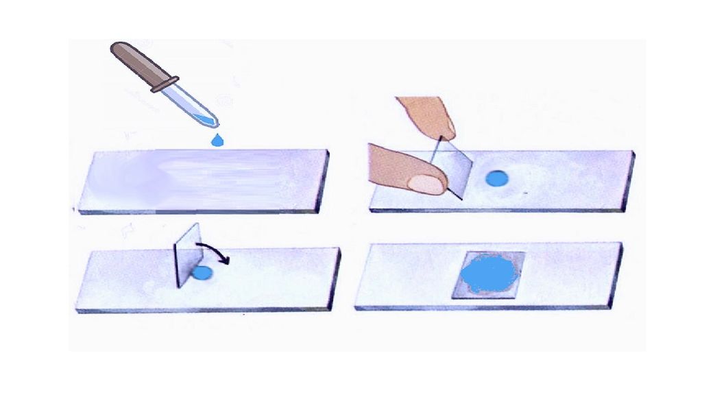 Метод висячая капля в микроскопии. Приготовление висячей капли. Приготовление препарата висячая капля. Приготовление висячей капли. Метод раздавленная капля микробиология.
