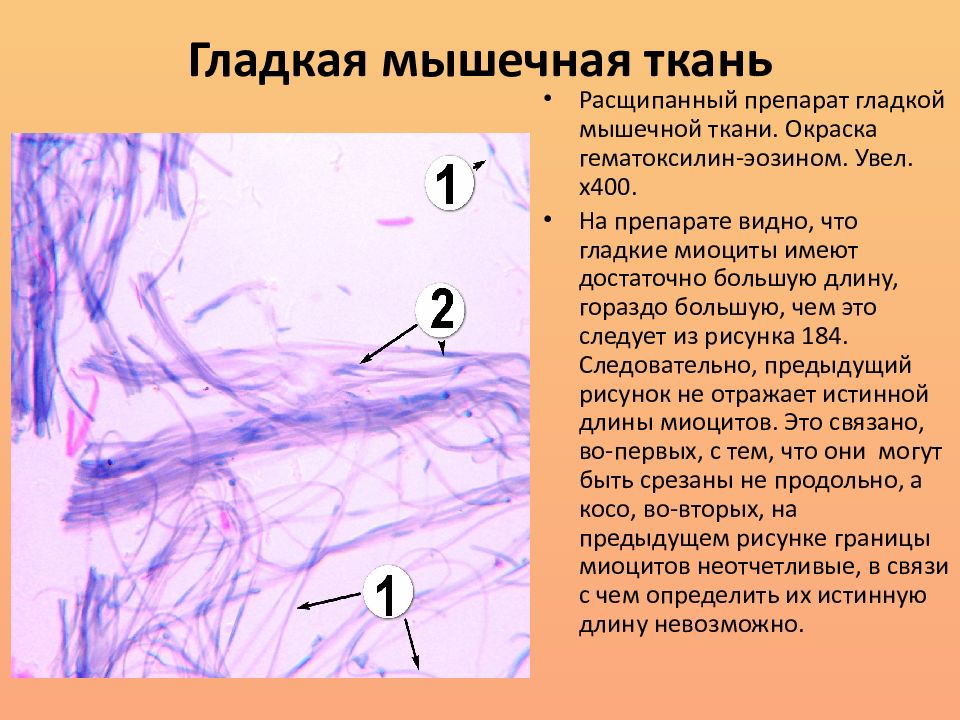 Ткань препарат. Гладкая мышечная ткань препарат. Гладкая мышечная ткань окраска гематоксилином и эозином. Гистогенез гладкой мышечной ткани. Гладкая мышечная ткань гематоксилин эозин.