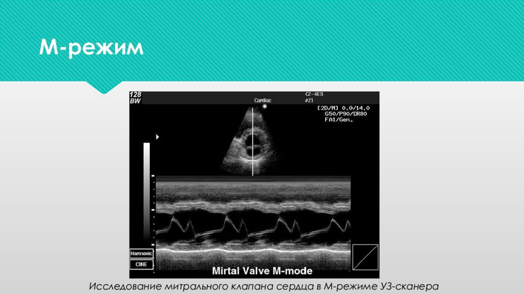 Режимы ультразвукового исследования
