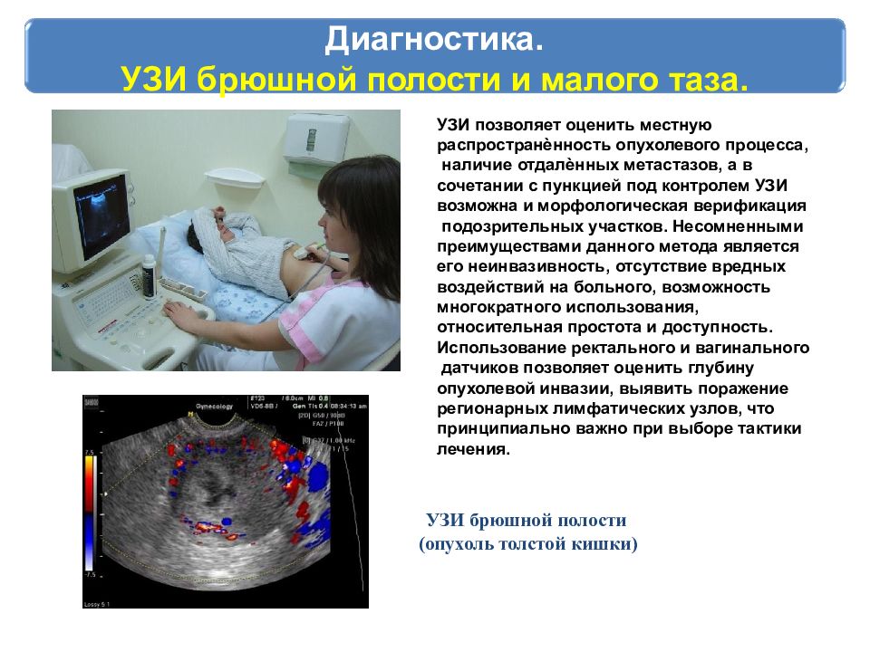 Рак презентация. Ответы УЗИ малого таза на белом фоне.