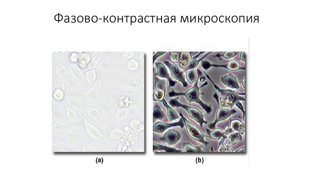 Фазово контрастная микроскопия. Метод фазового контраста в микроскопии микроскоп. Фазово-контрастная микроскопия микробиология. Тромбоциты фазово-контрастная микроскопия. Микоплазма в фазово контрастной микроскопии.