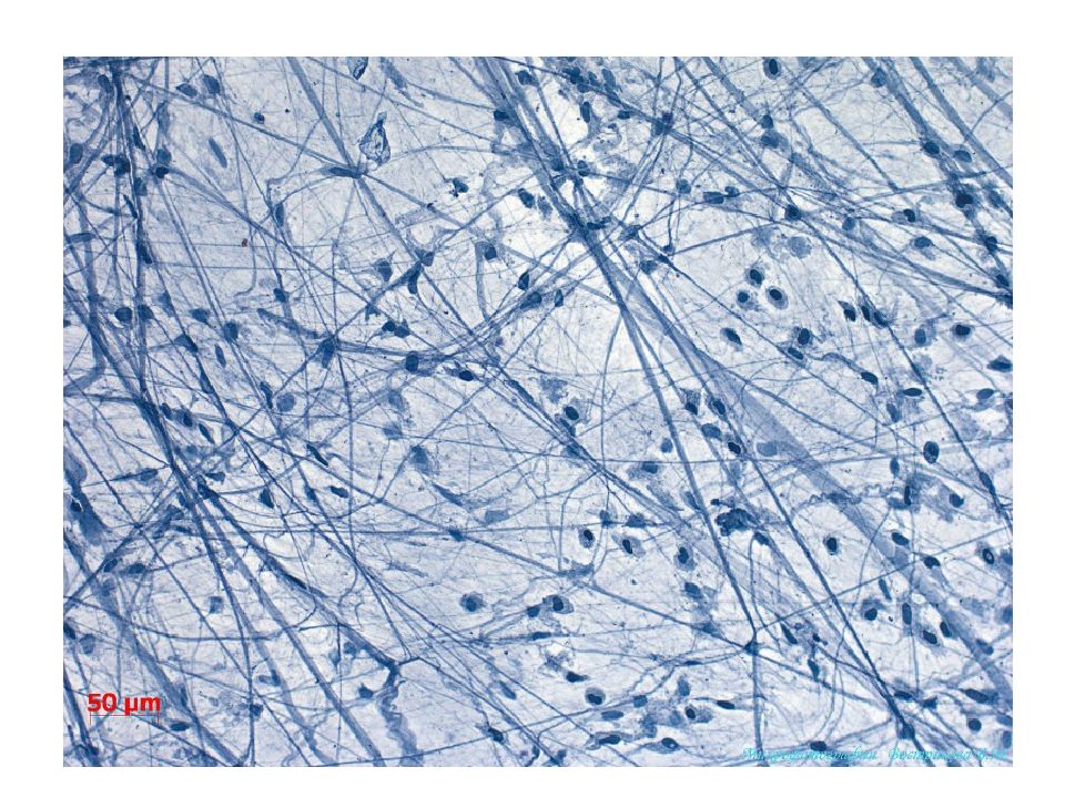 Ткань препарат. Рыхлая соединительная ткань гистология. Рыхлая волокнистая неоформленная соединительная ткань препарат. Рыхлая волокнистая соединительная ткань препарат. Волокнистая соединительная ткань гистология.