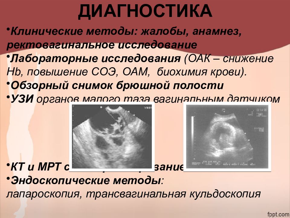 Злокачественные опухоли женских половых органов презентация