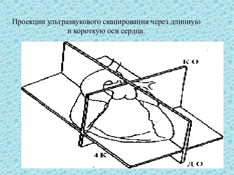 Принципы получения ультразвукового изображения сердца в трех режимах сканирования