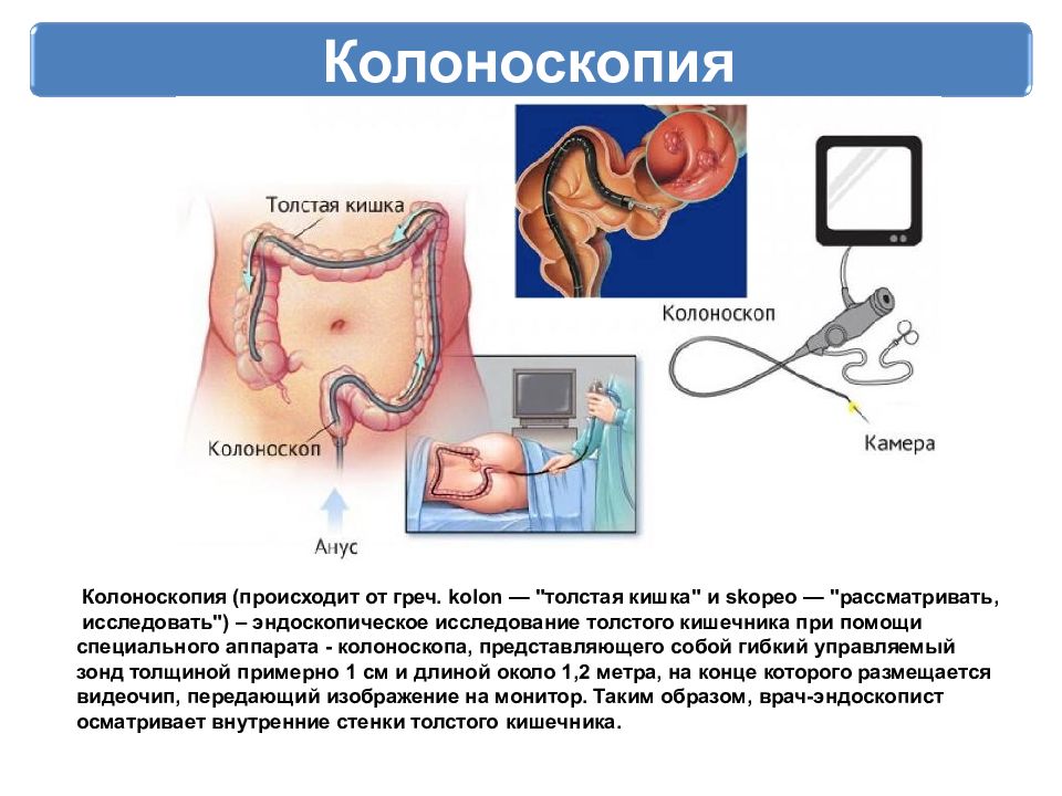 Результат колоноскопии. Колоноскопия аппарат.