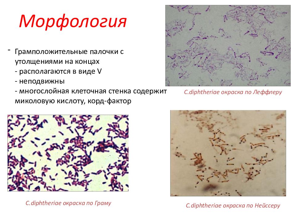 Дифтерия микробиология презентация