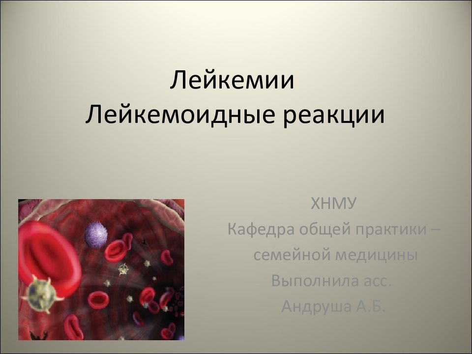 Лейкозы лейкемоидные реакции. Лейкемоидные реакции. Лейкозы и лейкемоидные реакции. Понятие о лейкемоидных реакциях. Лейкемоидной реакцией миелоидного типа.