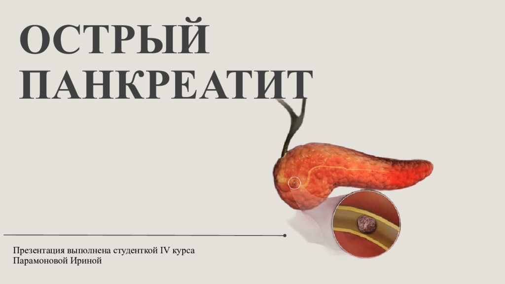 Острый Панкреатит