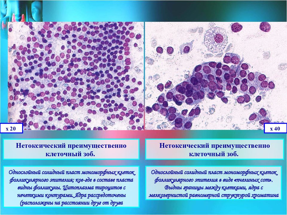 Цитологическая диагностика заболеваний молочной железы презентация