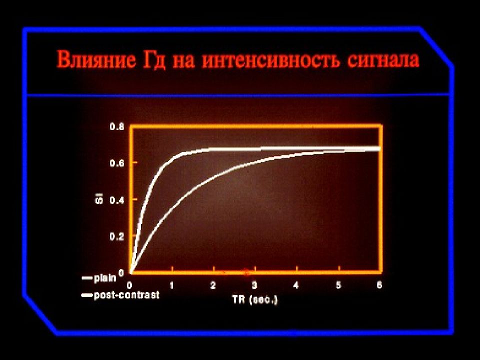 Интенсивность сигнала мрт. Интенсивность сигнала от разных тканей в мрт. Интенсивность сигнала воды при мрт.