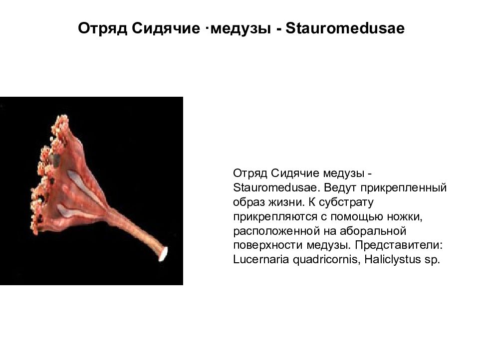 Прикрепленный образ жизни ведут. Ставромедузы строение. Отряд сидячие медузы. Ставромедузы жизненный цикл. Люцернария жизненный цикл.