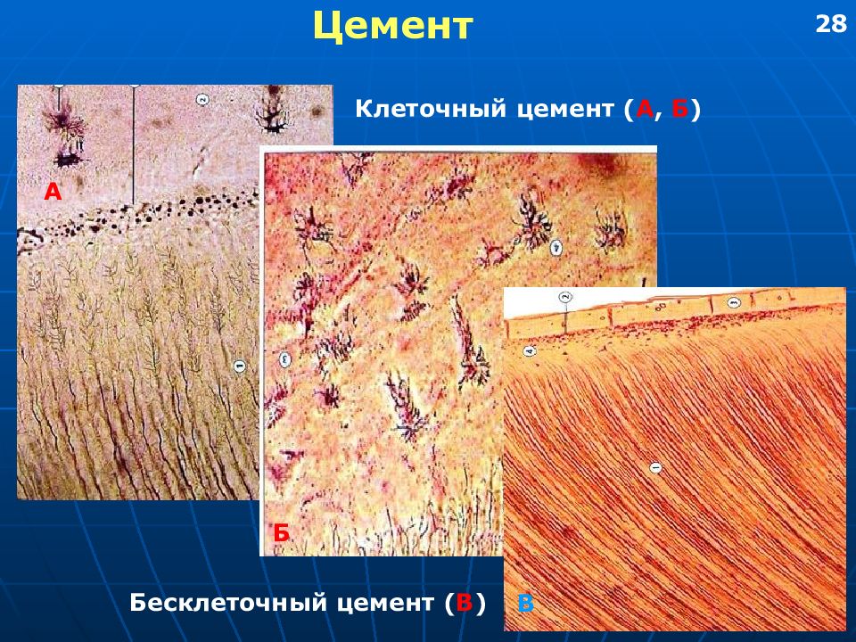 Цемент корень. Бесклеточный цемент зуба гистология. Строение цемента зуба гистология. Цемент зуба гистология бесклеточный и клеточный цемент. Строение цемента гистология.