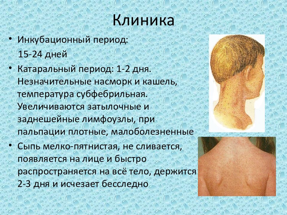 Инкубационный период кори