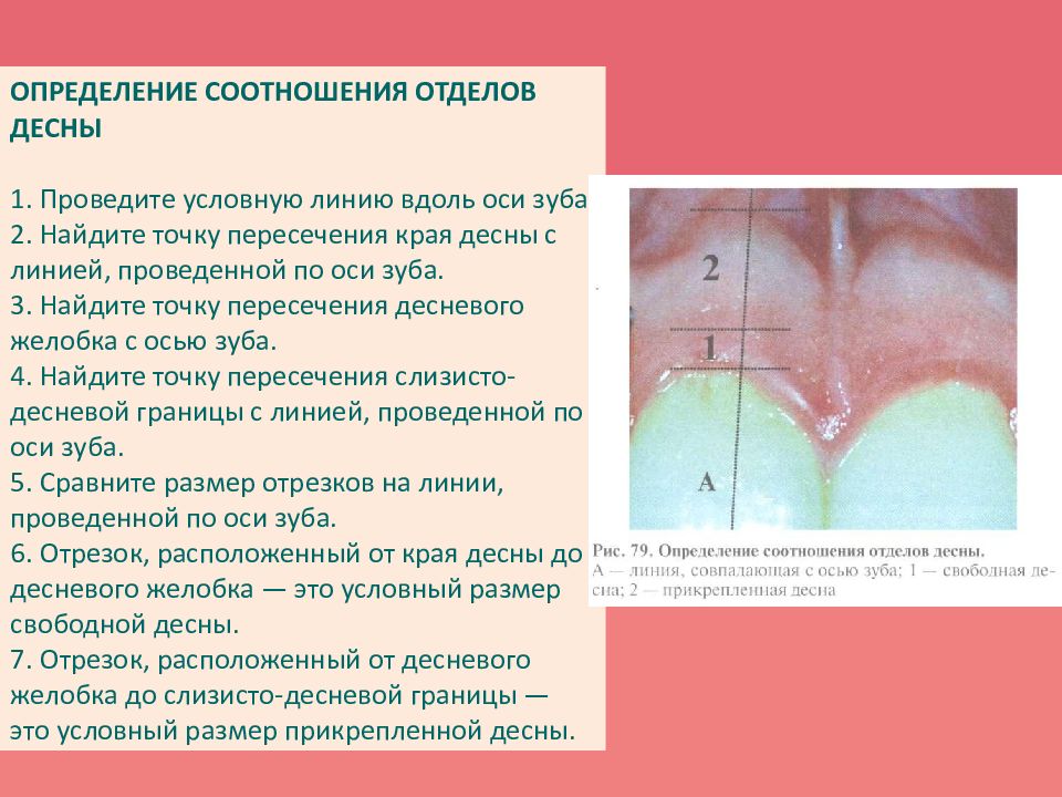 Обследование пародонта. Диагностика пародонта презентация. Обследование пародонта производят минимум в 4 точках. Доброкачественные опухоли пародонта реферат. Инъекция субмукозная в пародонта.