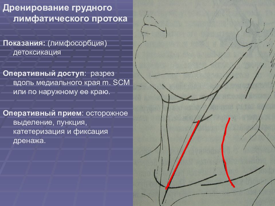 Топографическая анатомия и оперативная хирургия шеи презентация