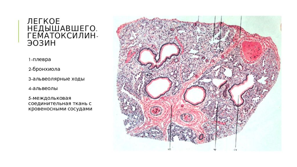 Легкое препарат. Легкое недышавшего гистология. Лёгкое плода гистология. Недышавшее легкое гистология препарат. Легкие плода гистология.