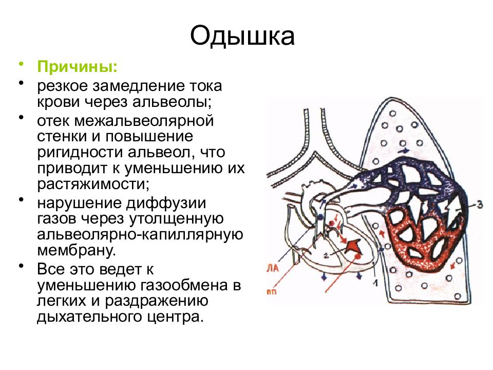 Слипанию стенок альвеол препятствует