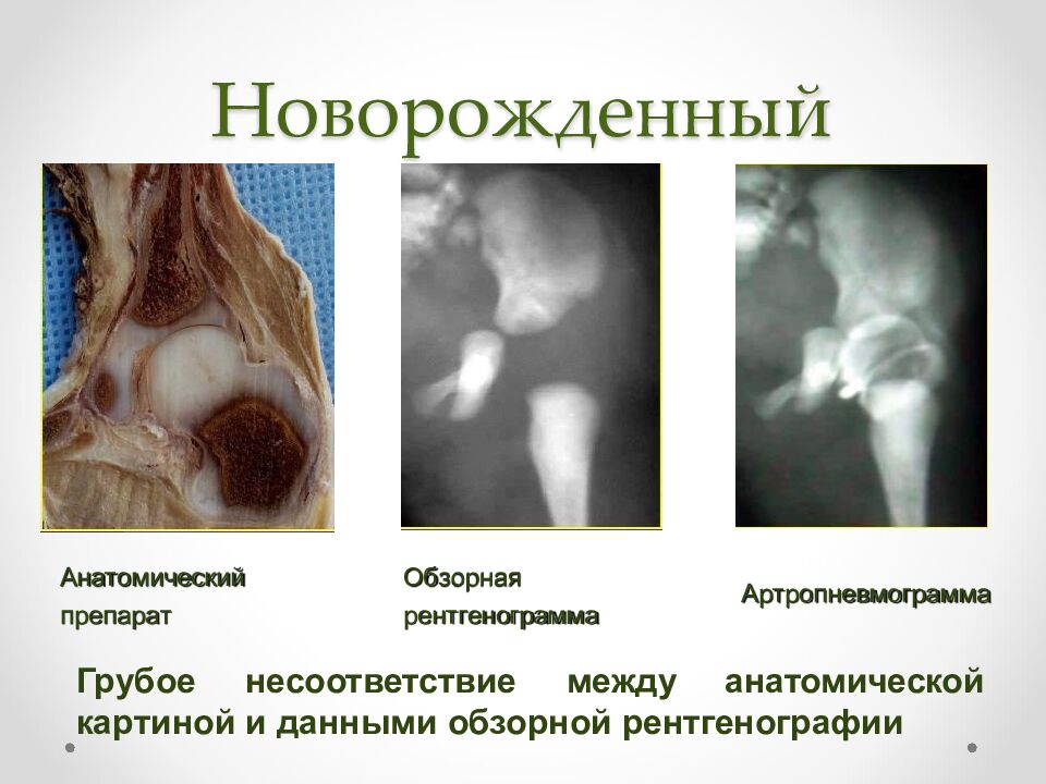 Новорожденный