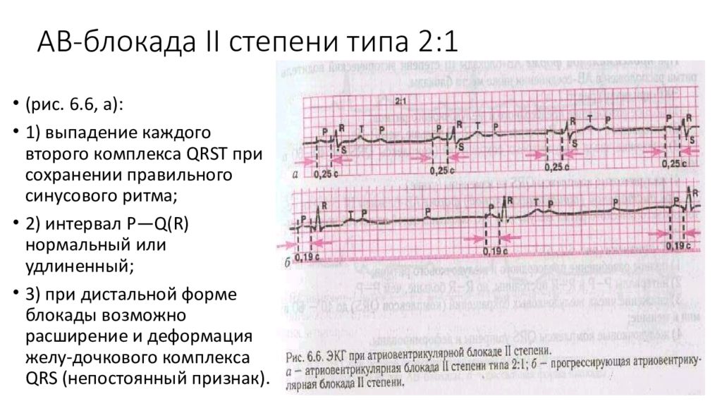 Ав блокада карта вызова