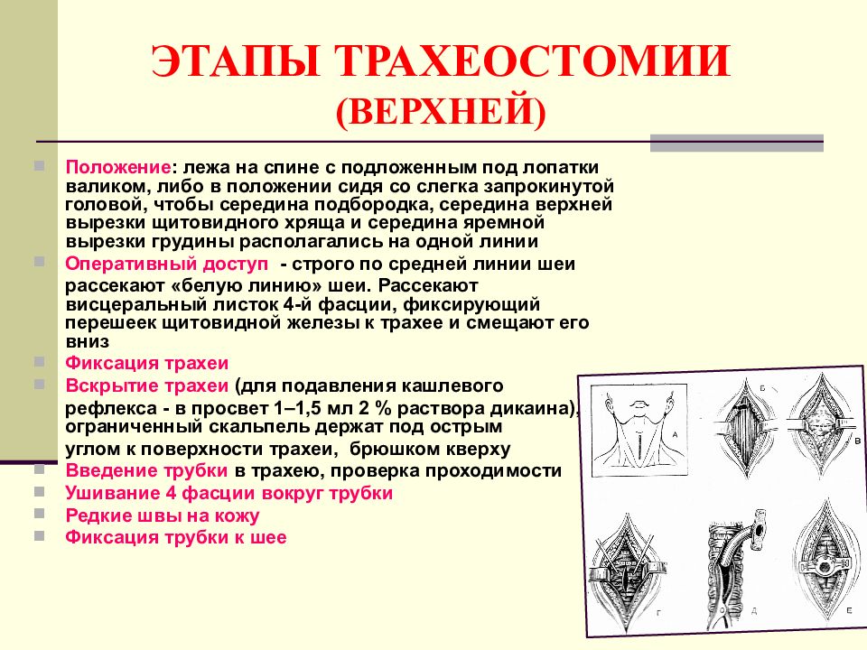 Операции на шее топографическая анатомия презентация