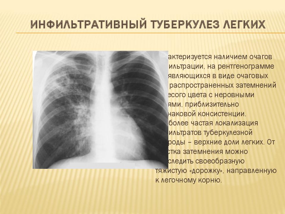 Изображение органов на рентгенограммах является ответ на тест