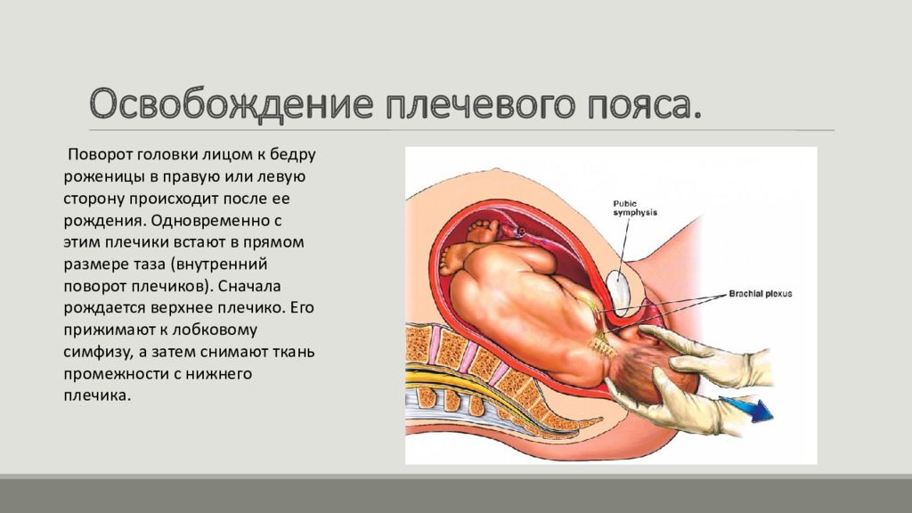 Родильница остается в зале после физиологических родов