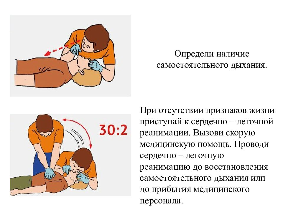 Презентация реанимационные мероприятия при оказании первой помощи