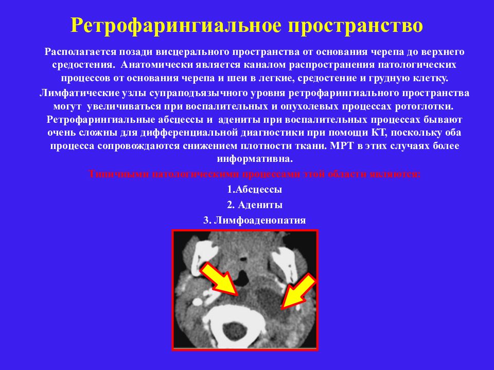 Лучевая диагностика заболеваний головы и шеи презентация