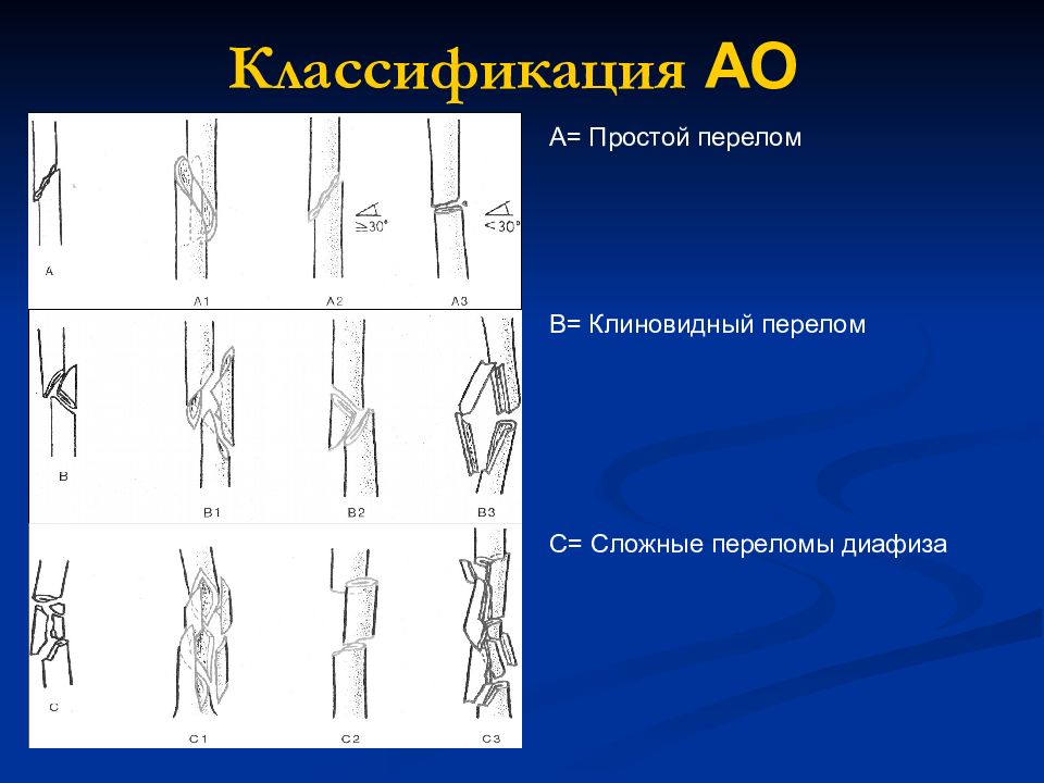 Переломы плечевой кости травматология презентация