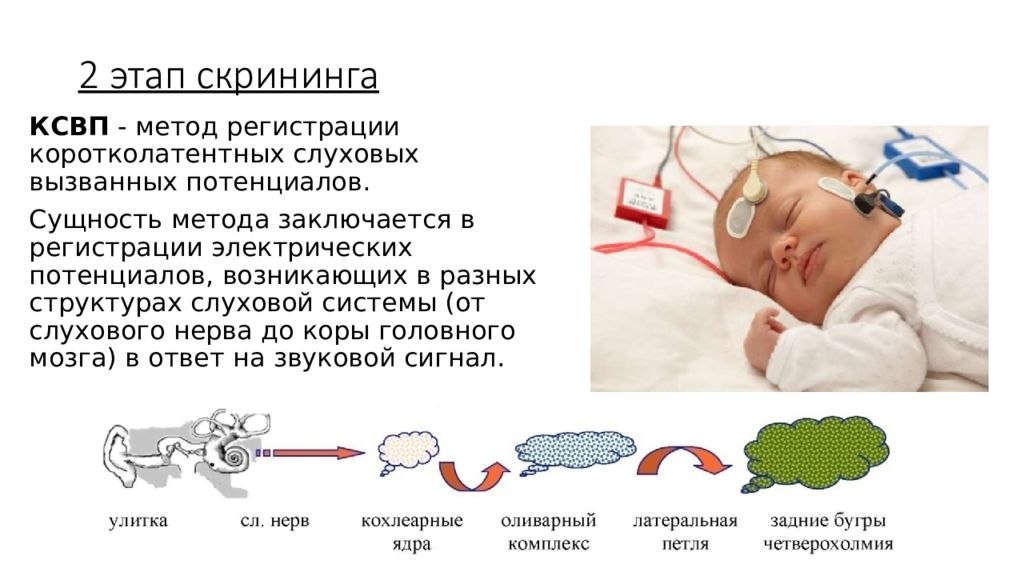 Вызови слух. Исследование слуха у детей раннего возраста. Коротколатентные слуховые вызванные потенциалы у детей. Вызванные потенциалы слуховые для ребенка. КСВП.