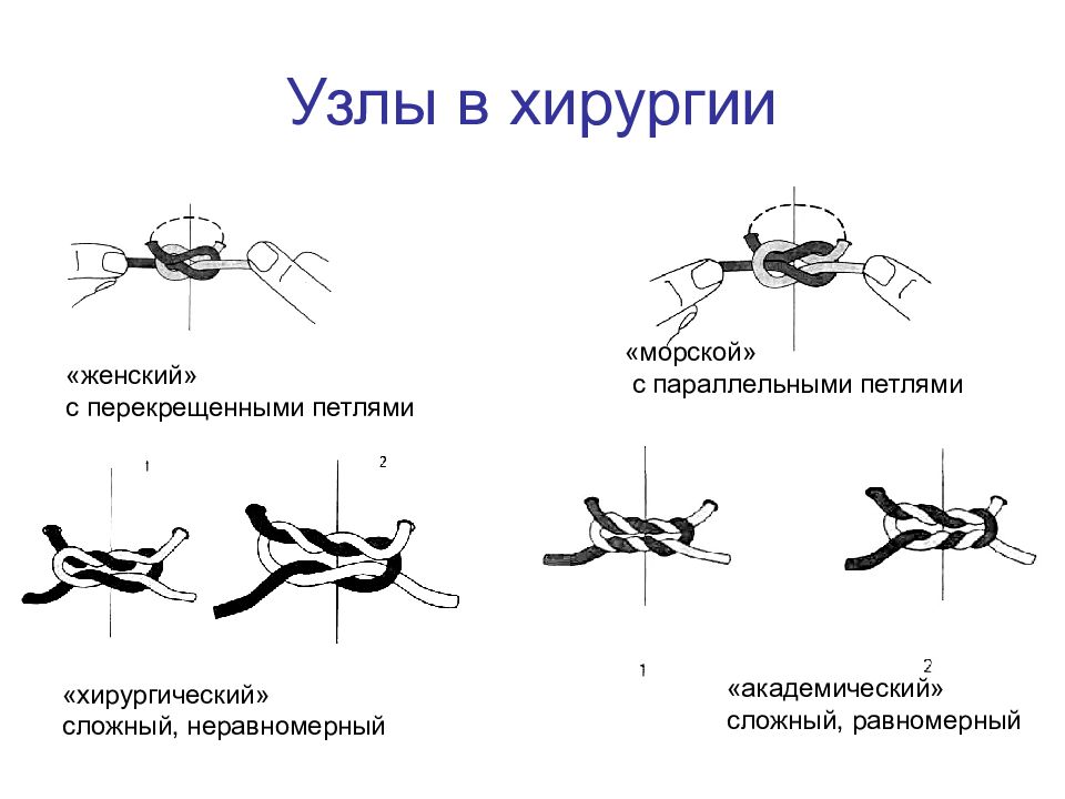 Схема хирургических швов