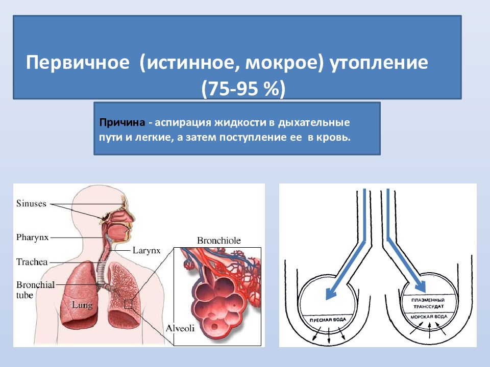 Аспирация дыхательных путей. Аспирационное утопление. Первичное (истинное) «мокрое» утопление.