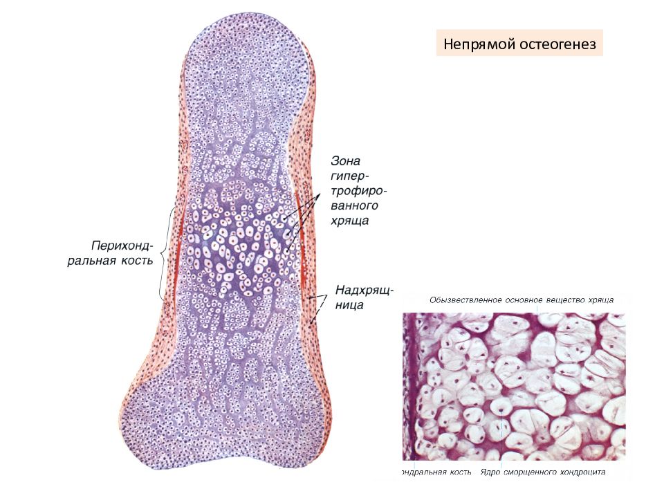 Развитие кости на месте хряща рисунок