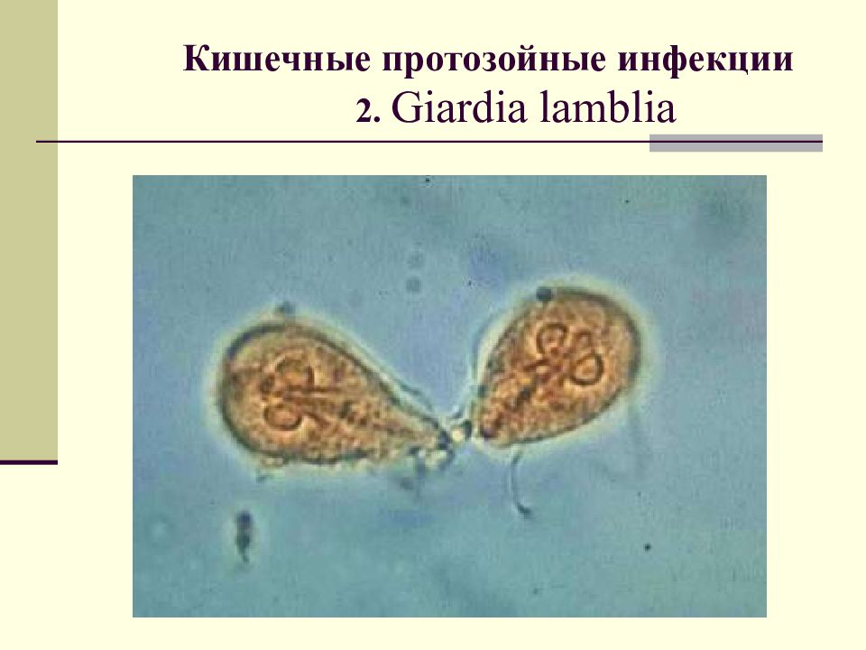 Кишечные протозойные инфекции. Возбудители протозойных кишечных инфекций. Возбудители протозойных кишечных инвазий лямблиоз.