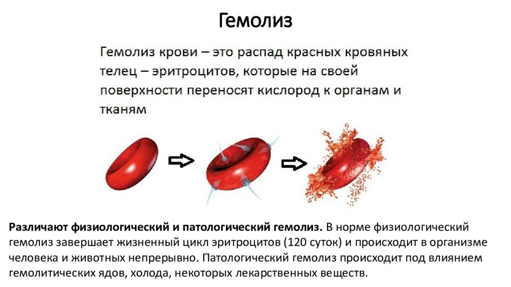 Гемолиз образца крови что это