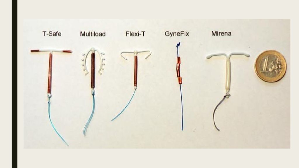 Вмк в гинекологии. Типы внутриматочных спиралей. Спираль противозачаточная Мирена. Медьсодержащие ВМС. Внутриматочные противозачаточные спирали.