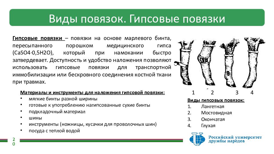 Основное правило наложения транспортной шины. Шинные повязки. Шинные повязки виды. Правила наложения транспортных шин. Правила наложения шинной повязки.