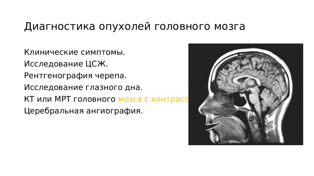 Диагностика опухолей головного мозга презентация