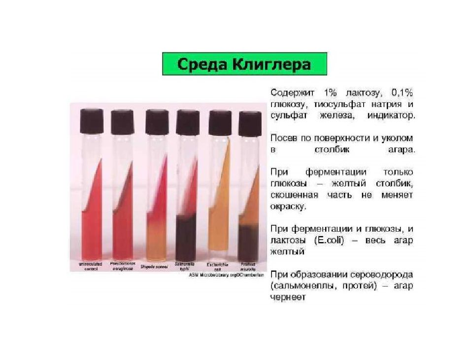 Среда роста. Среда Клиглера состав. Среда Клиглера микробиология принцип действия. Рост сальмонелл на среде Клиглера. Среде Ресселя Клиглера состав.